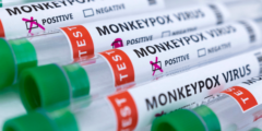 الولايات المتحدة تعلن تفشي مرض جدري القرود على أنه حالة طوارئ صحية